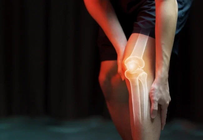 Joint Replacement