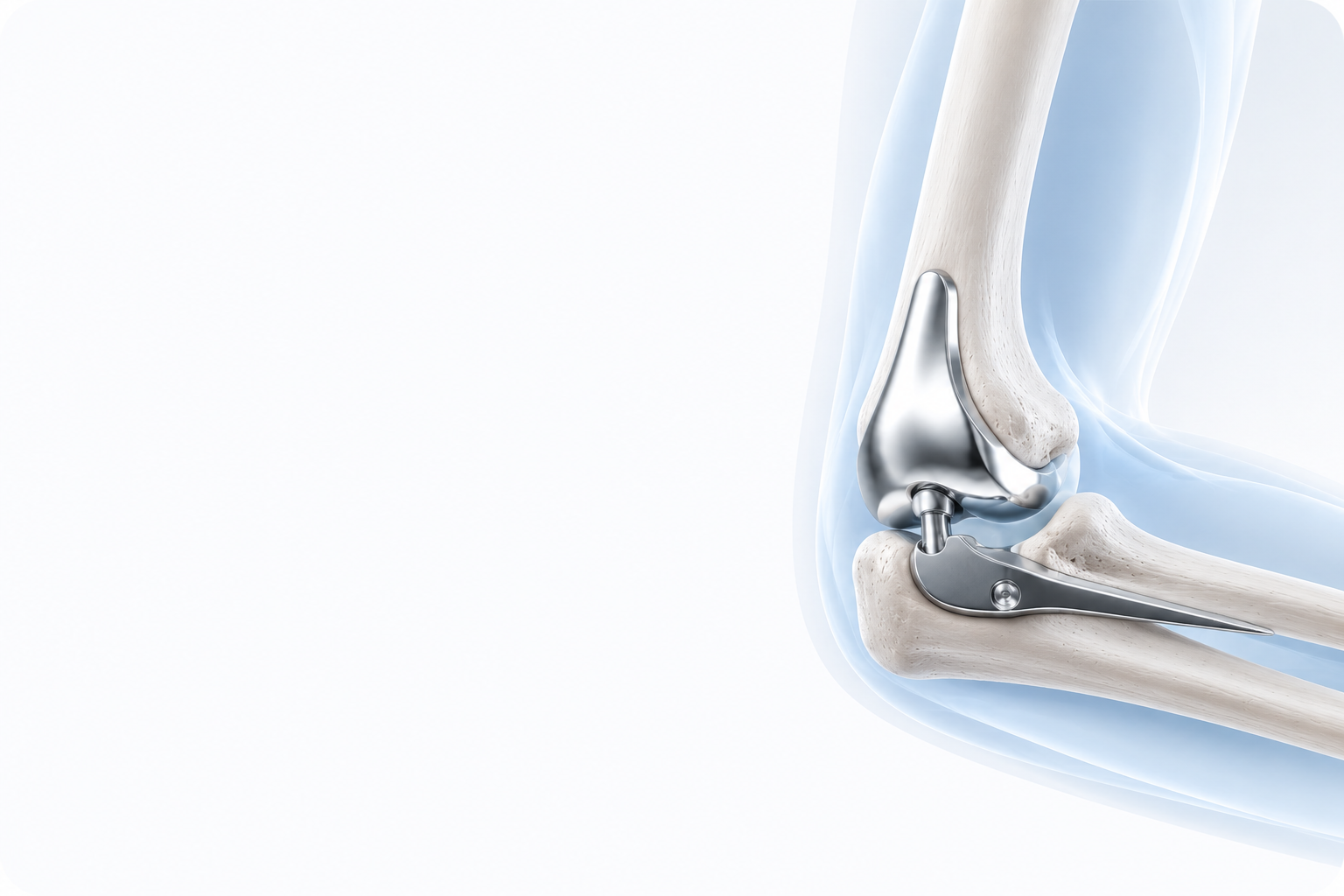 Elbow Replacement Treatment