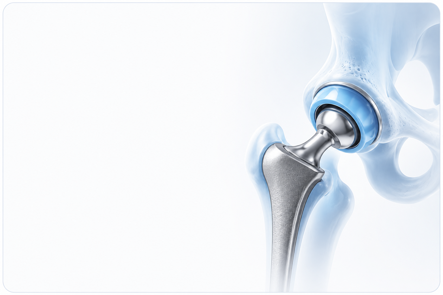 Knee Replacement Treatment